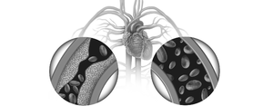 Chelation | EDTA | Consultation Fee